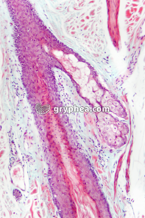 Glande sébacée x 40 - gryphea.org